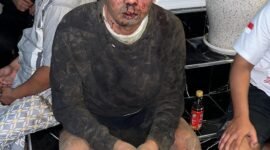 Dokumen foto : korban pengeroyokan pemilik Rental